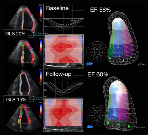 what does systolic function mean.